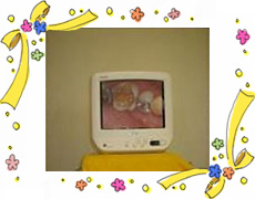 口内映像