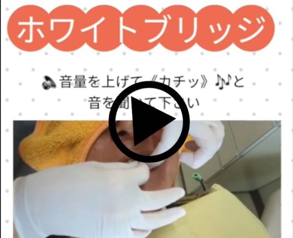 ホワイトブリッジ